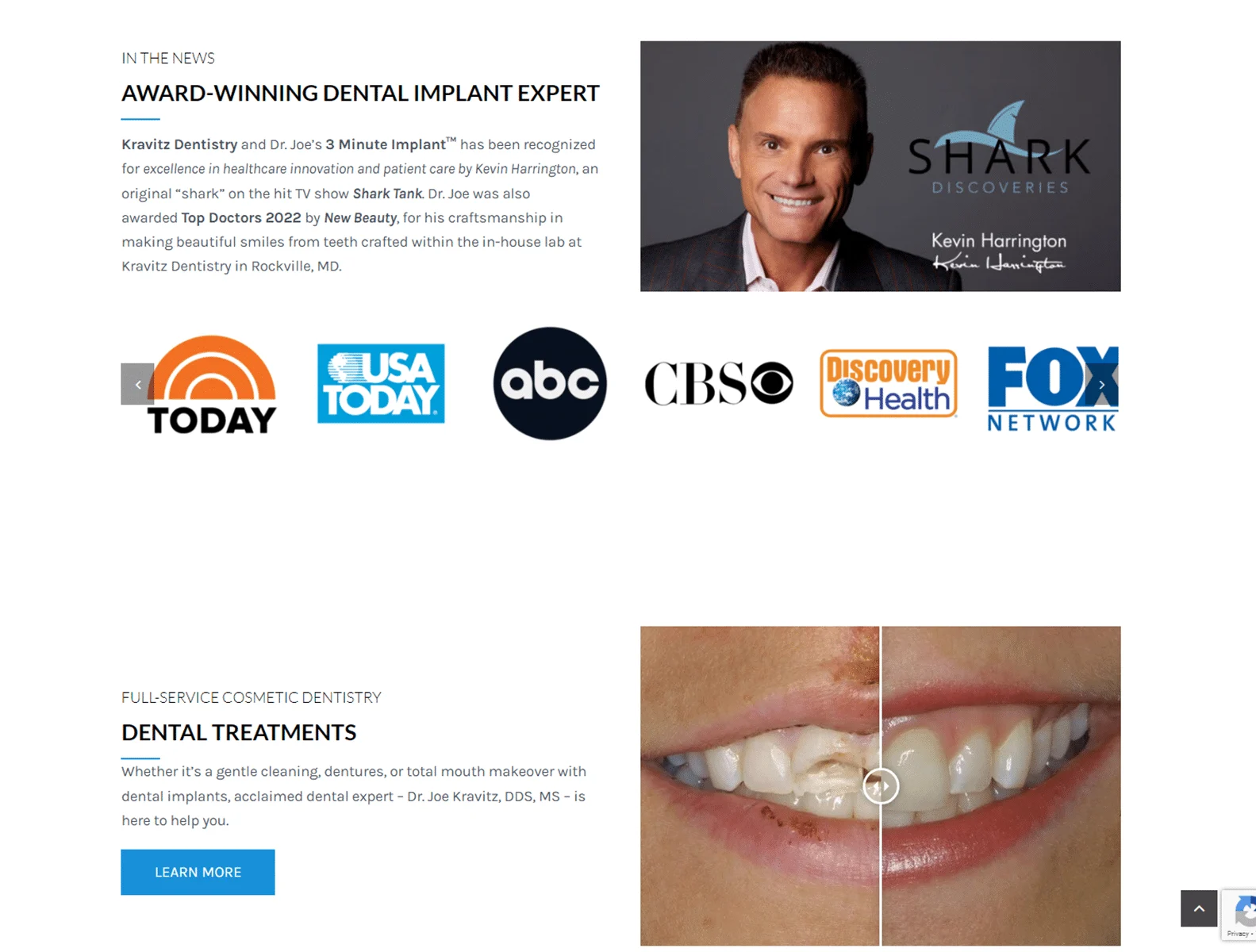 Rockville-Dental-Implants-Dentist-Dr-Joe-Kravitz-Dds-Ms (1) rockville dental implants dentist dr joe kravitz dds ms 1